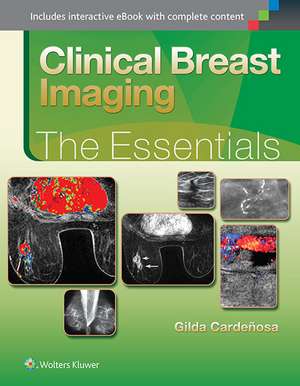 Clinical Breast Imaging: The Essentials de Gilda Cardenosa MD, FACR