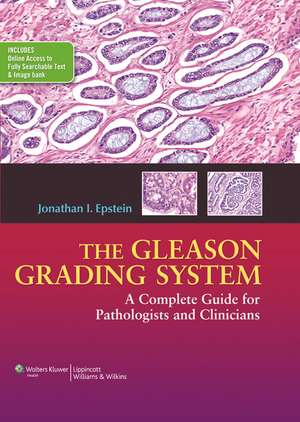 The Gleason Grading System: A Complete Guide for Pathologist and Clinicians de Jonathan I. Epstein