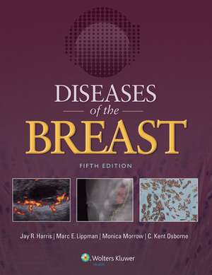 Diseases of the Breast 5e de Jay R. Harris MD