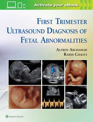 First Trimester Ultrasound Diagnosis of Fetal Abnormalities de Alfred Z. Abuhamad