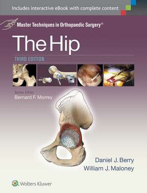 Master Techniques in Orthopaedic Surgery: The Hip de Daniel J. Berry MD