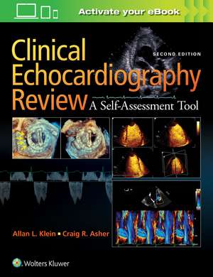 Clinical Echocardiography Review de Allan L. Klein