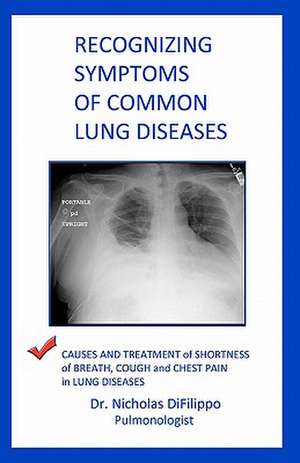 Recognizing Symptoms of Common Lung Diseases de Nicholas Difilippo