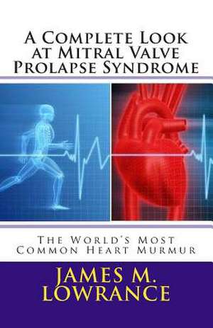 A Complete Look at Mitral Valve Prolapse Syndrome de James M. Lowrance