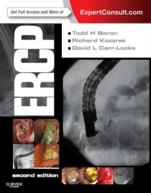 ERCP de Todd H. Baron