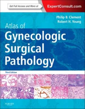 Atlas of Gynecologic Surgical Pathology: Expert Consult: Online and Print de Philip B. Clement