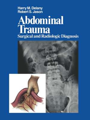 Abdominal Trauma: Surgical and Radiologic Diagnosis de H. M. Delany