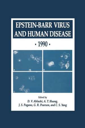 Epstein-Barr Virus and Human Disease · 1990 de D. V. Ablashi