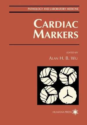 Cardiac Markers de Alan H. B. Wu