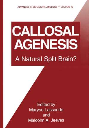 Callosal Agenesis: A Natural Split Brain? de Maryse Lassone