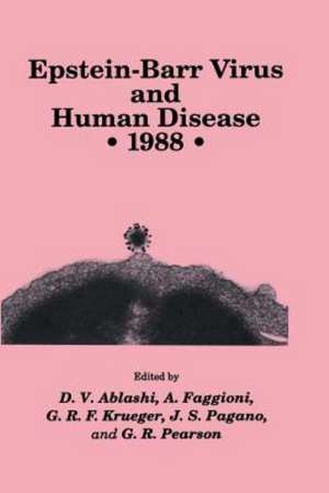 Epstein-Barr Virus and Human Disease • 1988 de D. V. Ablashi