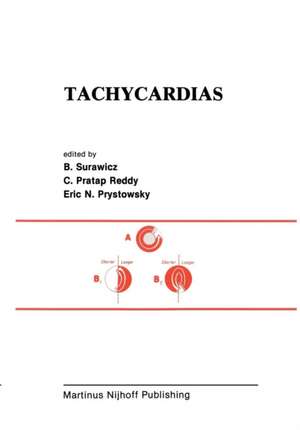 Tachycardias de Borys Surawicz