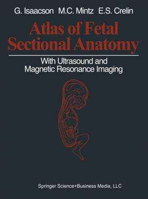 Atlas of Fetal Sectional Anatomy: With Ultrasound and Magnetic Resonance Imaging de Glenn Isaacson