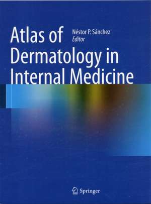 Atlas of Dermatology in Internal Medicine de Néstor P. Sánchez