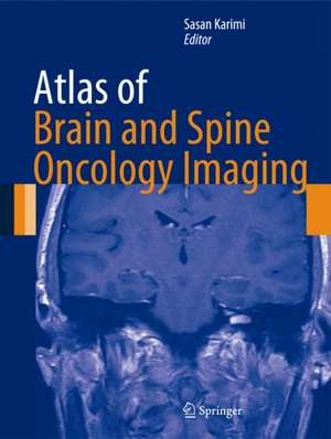 Atlas of Brain and Spine Oncology Imaging de Sasan Karimi