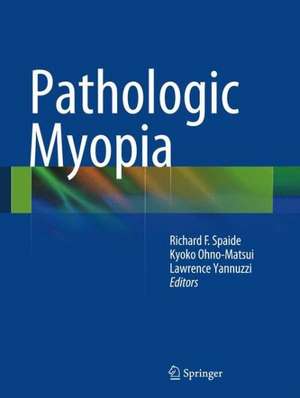 Pathologic Myopia de Richard F. Spaide