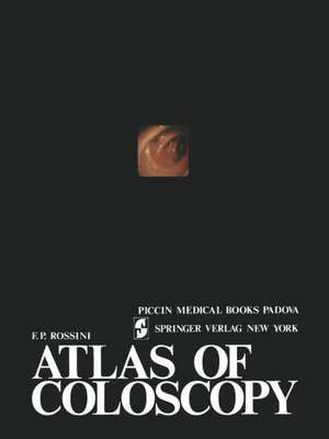 Atlas of coloscopy de Rossini