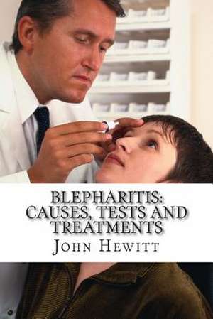 Blepharitis de John Hewitt Ma