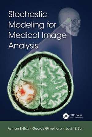 Stochastic Modeling for Medical Image Analysis de Ayman El-Baz