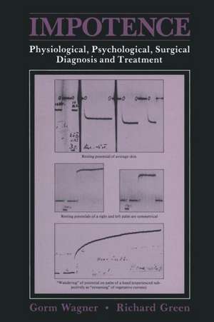 Impotence: Physiological, Psychological, Surgical Diagnosis and Treatment de Gorm Wagner