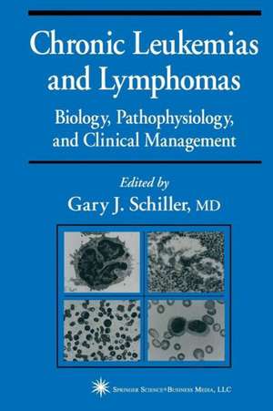 Chronic Leukemias and Lymphomas: Biology, Pathophysiology, and Clinical Management de Gary J. Schiller