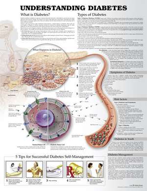 Understanding Diabetes Anatomical Chart de Anatomical Chart Company