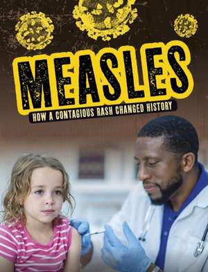 MEASLES de LEWIS MARK K