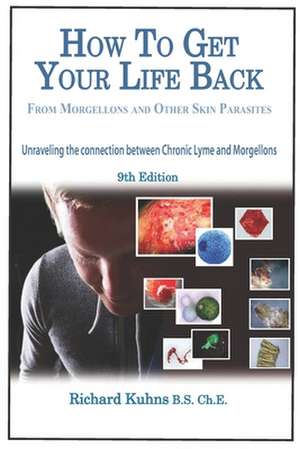 How to Get Your Life Back from Morgellons and Other Skin Parasites Limited Edit de MR Richard L. Kuhns