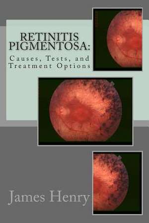 Retinitis Pigmentosa de James Henry Ma