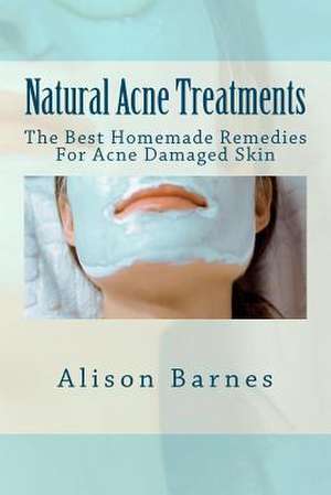 Natural Acne Treatments de Alison Barnes