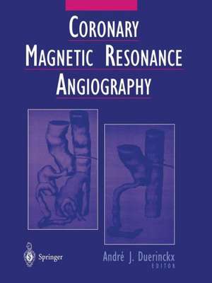 Coronary Magnetic Resonance Angiography de Andre J. Duerinckx