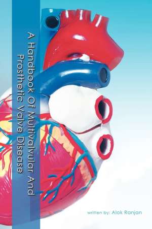 A Handbook Of Multivalvular and Prosthetic Valve Disease de Alok Ranjan