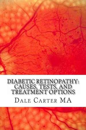 Diabetic Retinopathy de Dale Carter Ma