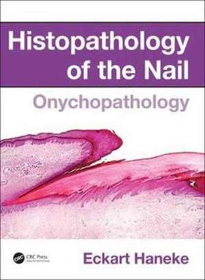 Histopathology of the Nail: Onychopathology de Eckart Haneke