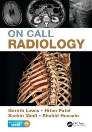 On Call Radiology de Gareth Lewis