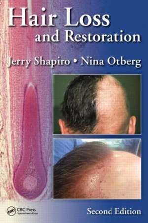 Hair Loss and Restoration de Jerry Shapiro