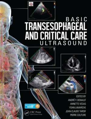 Basic Transesophageal and Critical Care Ultrasound de André Denault