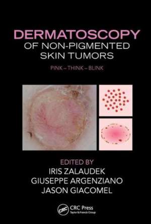 Dermatoscopy of Non-Pigmented Skin Tumors: Pink - Think - Blink de Iris Zalaudek