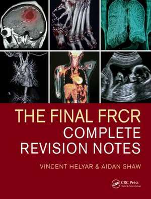 The Final FRCR: Complete Revision Notes de Vincent Helyar