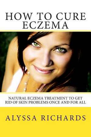 How to Cure Eczema de Alyssa Richards