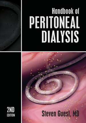 Handbook of Peritoneal Dialysis de MD Steven Guest