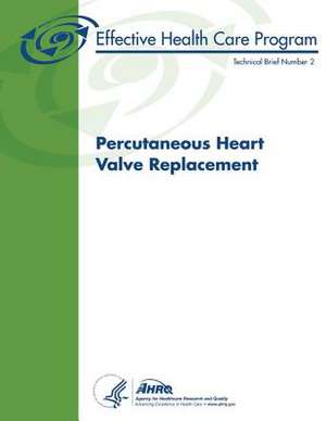 Percutaneous Heart Valve Replacement de U. S. Department of Heal Human Services