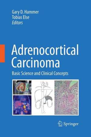 Adrenocortical Carcinoma: Basic Science and Clinical Concepts de Gary D. Hammer