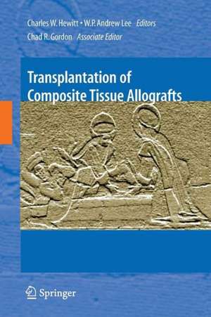 Transplantation of Composite Tissue Allografts de Charles W. Hewitt