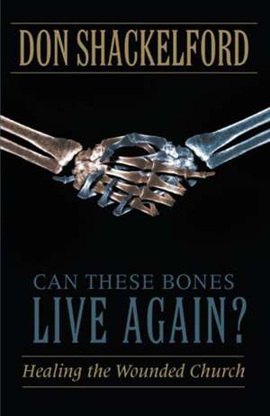 Can These Bones Live Again? de Don Shackelford