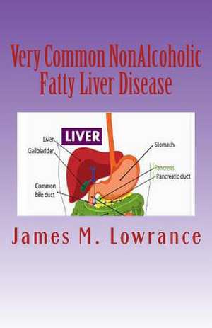 Very Common Nonalcoholic Fatty Liver Disease de James M. Lowrance