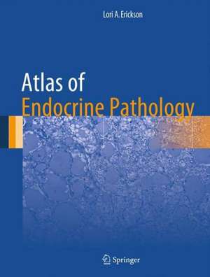 Atlas of Endocrine Pathology de Lori A. Erickson