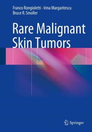 Rare Malignant Skin Tumors de Franco Rongioletti