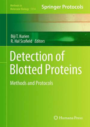 Detection of Blotted Proteins: Methods and Protocols de Biji T. Kurien