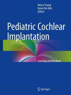 Pediatric Cochlear Implantation: Learning and the Brain de Nancy M Young